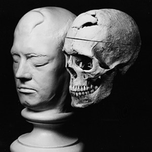 Phineas Gage life cast and skull. <span class="credit">Photo: Warren Anatomical Museum</span>