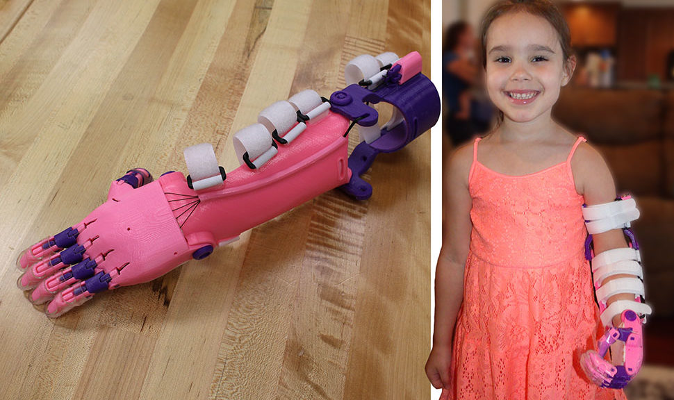 Five-year-old Katelyn poses with her new prosthetic limb, the “Unlimbited” design from the e-NABLE website. It was 3D printed by a group of volunteers at the Clear Lake City-County Freeman branch library in Harris County, Texas.