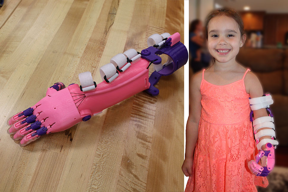 Five-year-old Katelyn poses with her new prosthetic limb, the “Unlimbited” design from the e-NABLE website. It was 3D printed by a group of volunteers at the Clear Lake City-County Freeman branch library in Harris County, Texas.